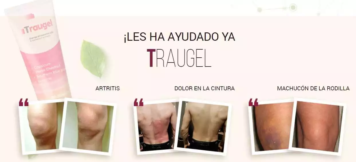 Compra Traugel en La Muñoza: Encuentra la mejor opción en nuestra farmacia online